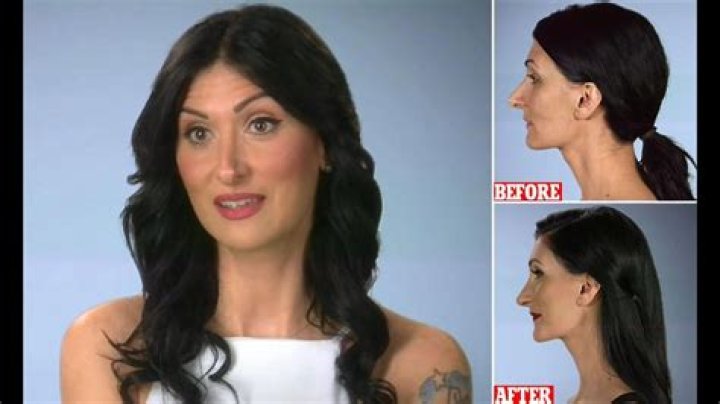 Ashley Greene’s Plastic Surgery Rumors — Has She Really Had a Nose Job?