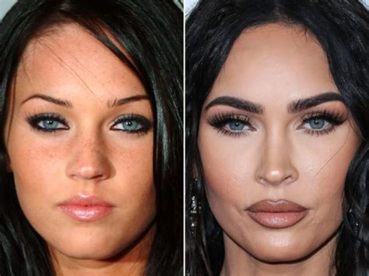 Did Stevie Wonder Have Plastic Surgery? Face Before And After