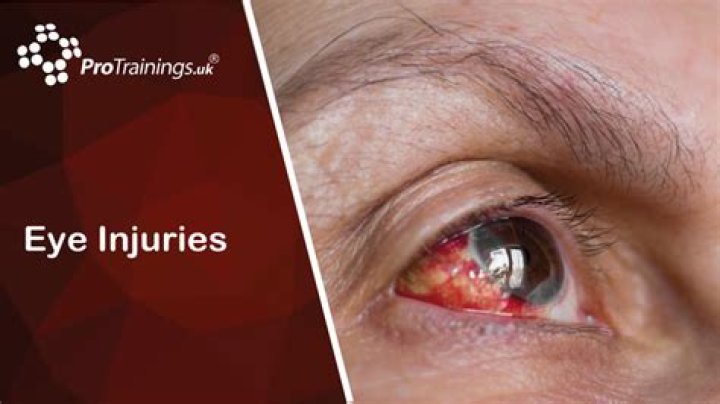 Does Ken Paxton Have A Glass Eye? Eye Injury And Accident