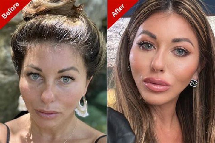 Has Tyler Hynes Done Plastic Surgery?