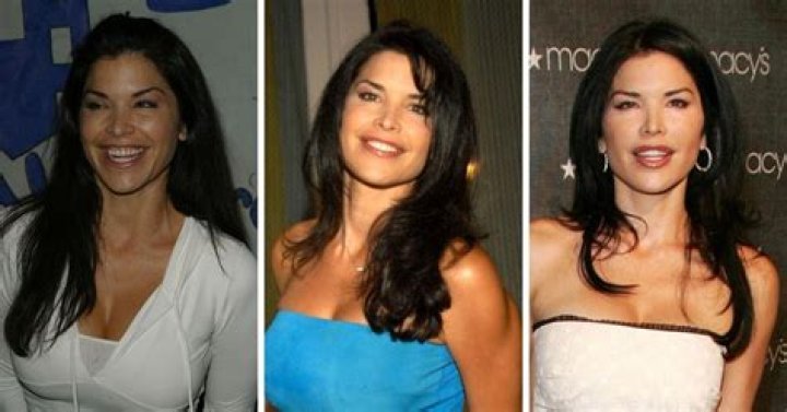Lauren Boebert Before And After Photos: Plastic Surgery Rumors