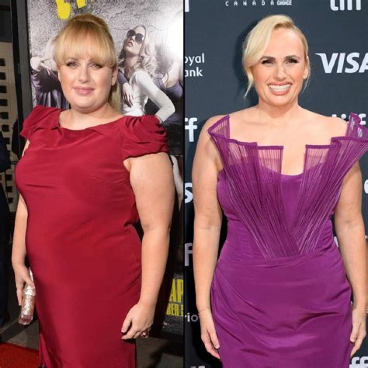 Naomi Watts Weight Loss Before And After; Has The Watcher Cast Done Surgery?