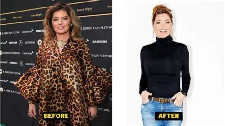 Shania Twain Facelift Surgery: Then And Now Photos